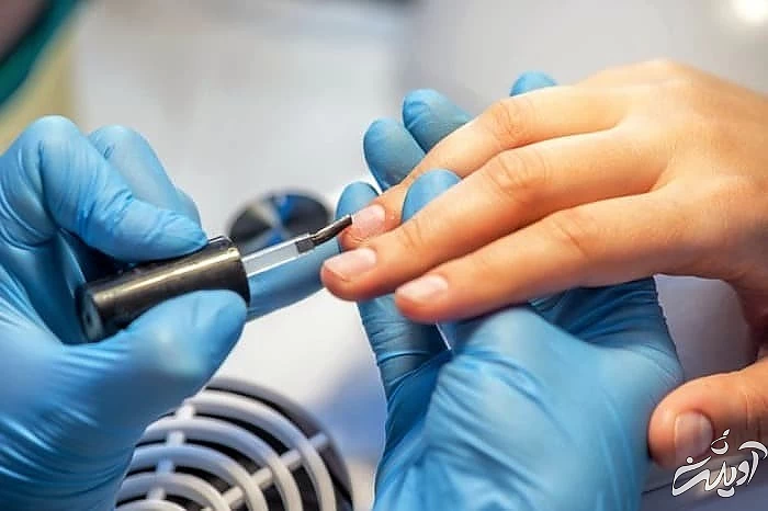 آسیبات ناخن